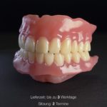 Digitale Zahnmedizin - Vollprothese Oberkiefer und Unterkiefer aus dem 3D-Drucker auf schwarzem Hintergrund, Seitenansicht.