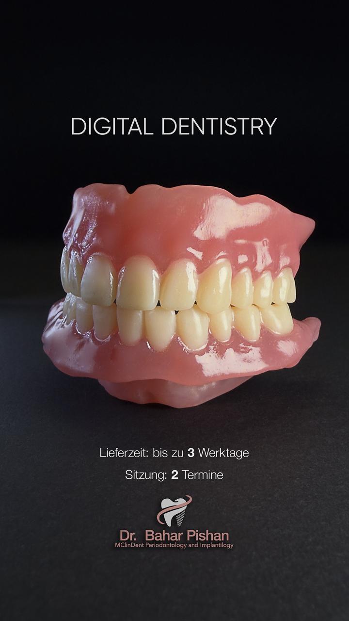 digitale-zahnmedizin-3d-druck-wien Digitale Zahnmedizin - Vollprothese Oberkiefer und Unterkiefer aus dem 3D-Drucker auf schwarzem Hintergrund, Seitenansicht.