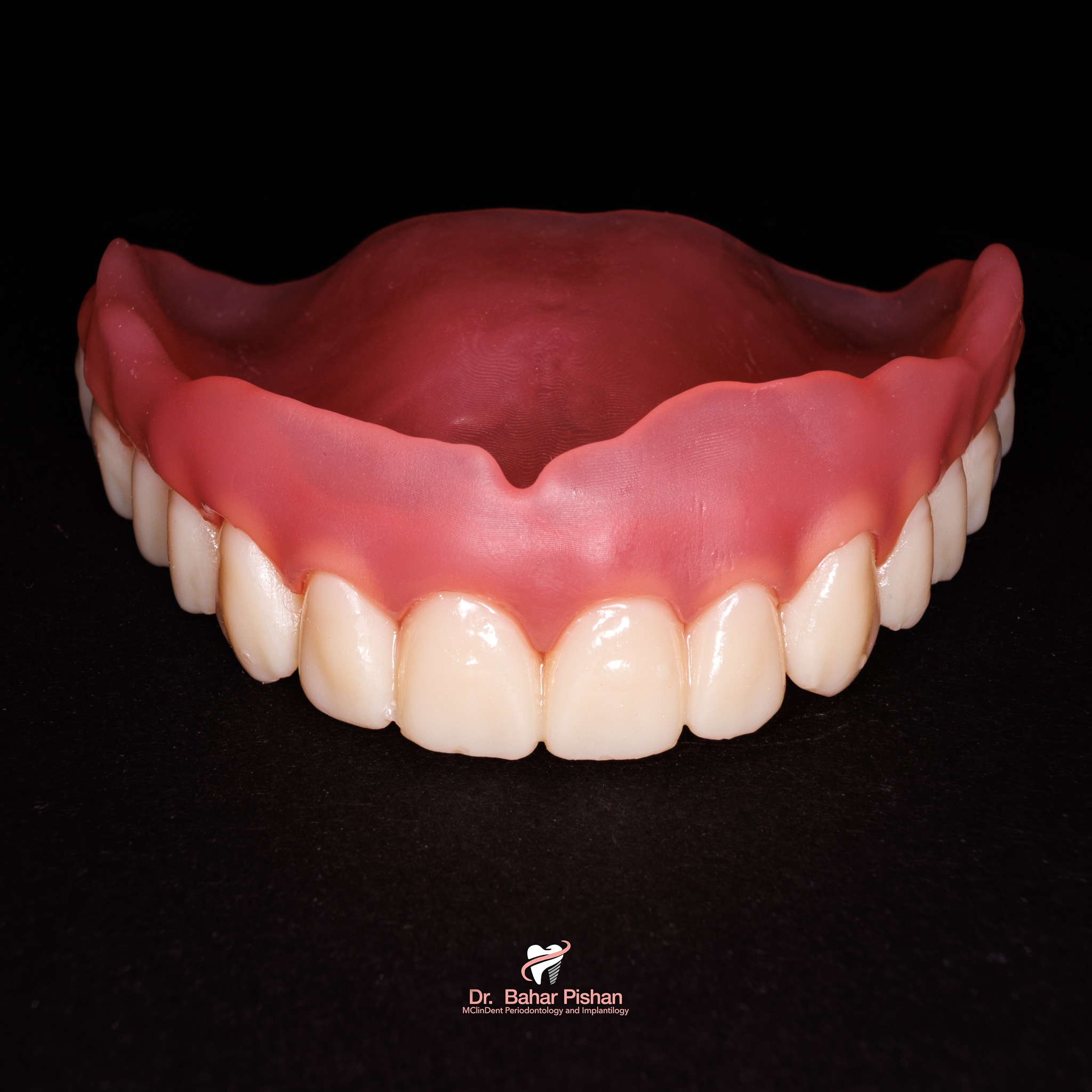 Total Protese Digitale Totalprothese (Oberkiefer)